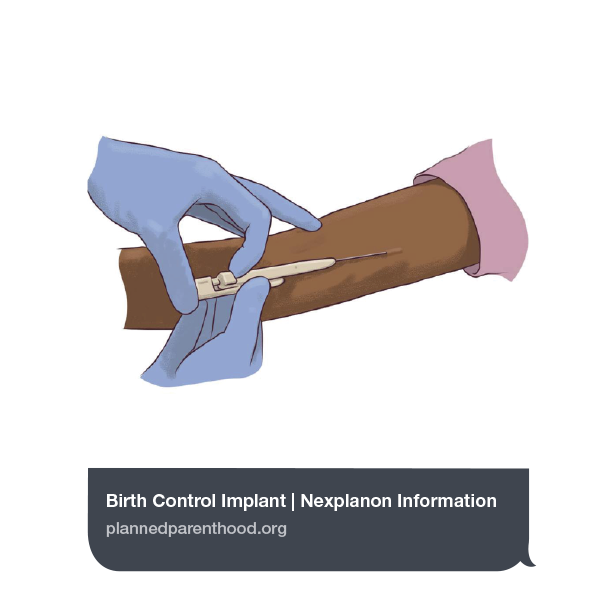 Implant Planned Parenthood Text Link